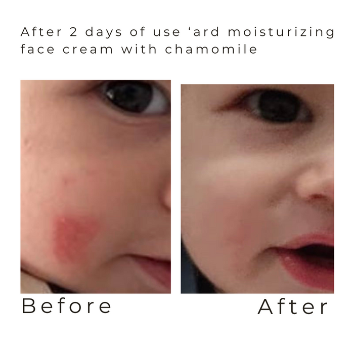 Ard moisturizing face cream with chamomile 50 ml