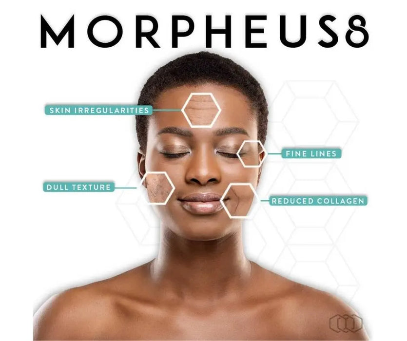 Morpheus8 for face and body