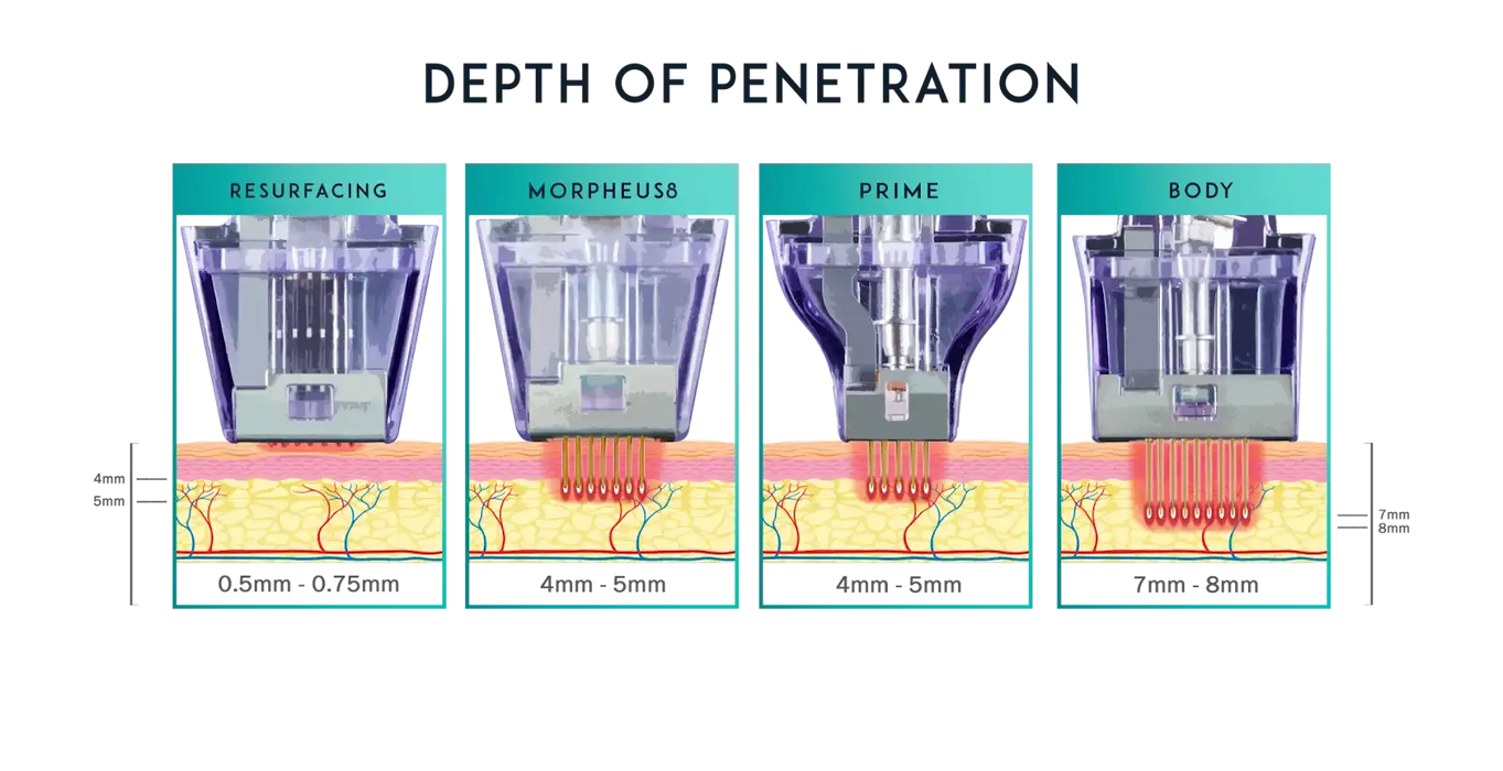 Morpheus8 for face and body