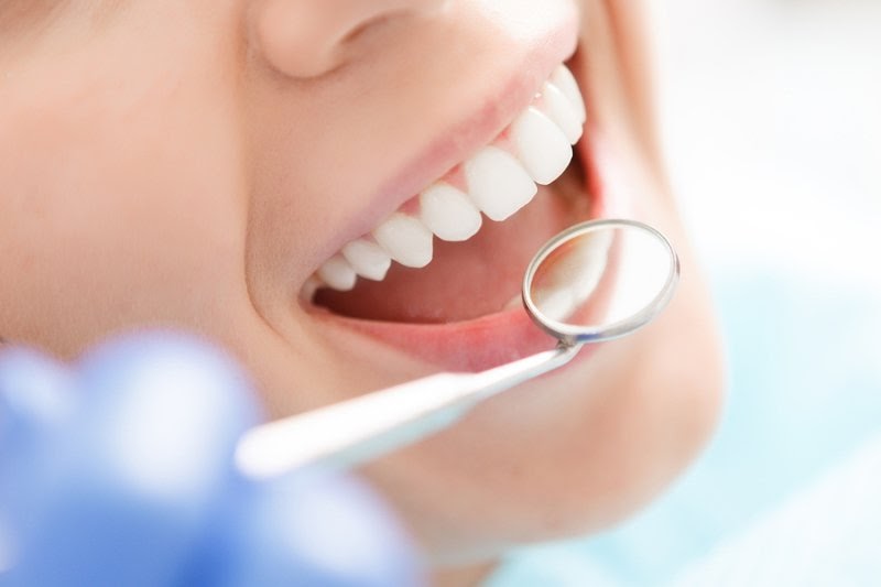 Scaling and polishing/teeth cleaning